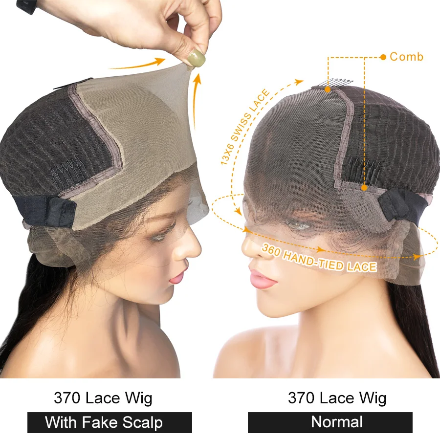 370with-fake-scalp
