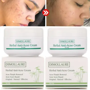 2pcs Dimollaure Acne Treatment cream Blackhead Removal Anti Acne Oil Control Repair Comedone Pimple Acne Scar Remove Face Care
2pcs Dimollaure Acne Treatment cream Blackhead Removal Anti Acne Oil Control Repair Comedone Pimple Acne Scar Remove Face Care
