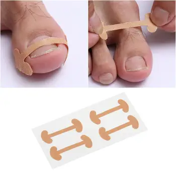 20pcs Toenail Stickers Toenail Correction Tool Ingrown Toe Nail Treatment Toenail Straightening Sticker for Home Shops
20pcs Toenail Stickers Toenail Correction Tool Ingrown Toe Nail Treatment Toenail Straightening Sticker for Home Shops