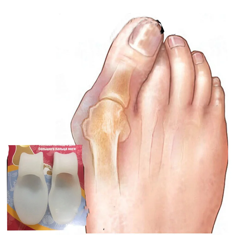 2pcs Silicone Gel Foot Fingers Toe Separator Thumb Valgus Protector Bunion Adjuster Hallux Valgus Pro Guard Feet Care
2pcs Silicone Gel Foot Fingers Toe Separator Thumb Valgus Protector Bunion Adjuster Hallux Valgus Pro Guard Feet Care
