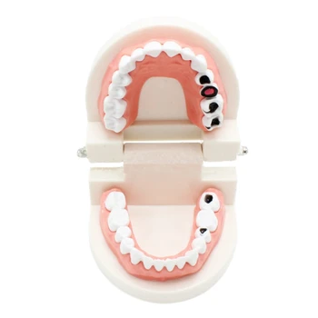 Implant Disease Teeth Model for s Teaching Oral Health Care Science Disease Teaching Study
Implant Disease Teeth Model for s Teaching Oral Health Care Science Disease Teaching Study