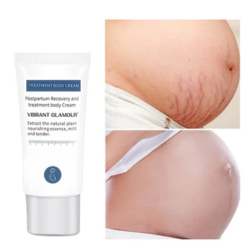 30ml Natural Mild Non-Irritating Stretch Mark Cream For Pregnancy Repair Scar Slack Line Abdomen Firming Body Cream
30ml Natural Mild Non-Irritating Stretch Mark Cream For Pregnancy Repair Scar Slack Line Abdomen Firming Body Cream