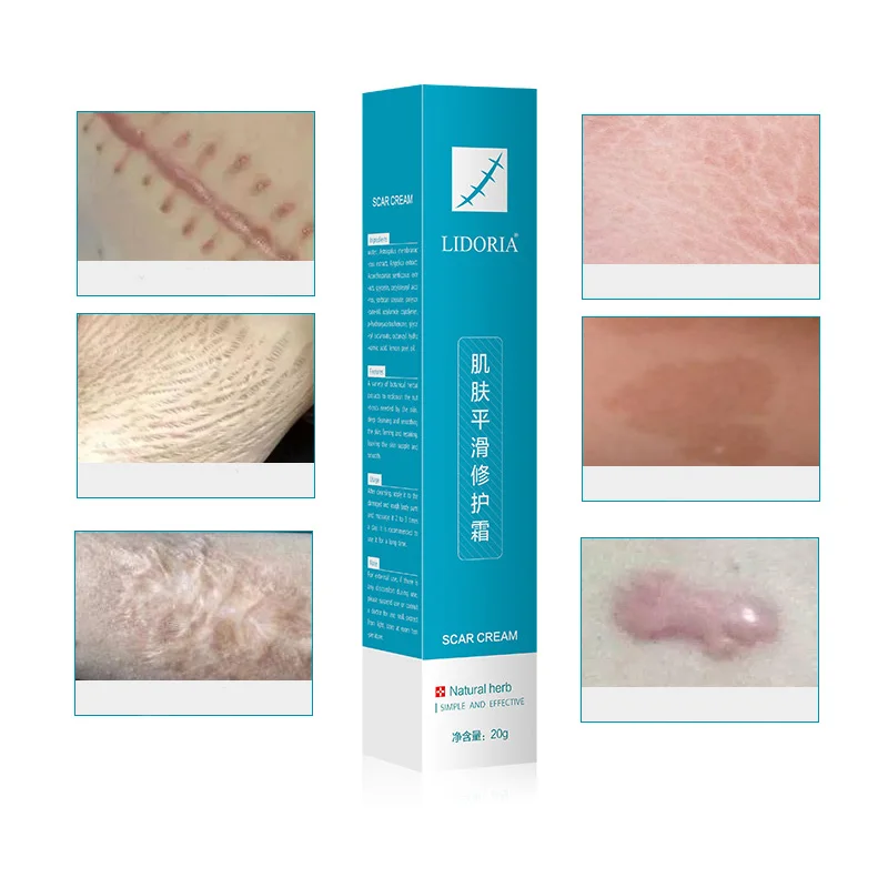 Scar Removal Cream Remove Acne Scars Surgical Scar Burning for Body Pigmentation Corrector Cream Stretch Marks Cream TSLM1
Scar Removal Cream Remove Acne Scars Surgical Scar Burning for Body Pigmentation Corrector Cream Stretch Marks Cream TSLM1