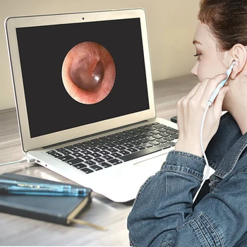 3 In 1 Multifunction In Ear Cleaning Endoscope Usb Visual Ear Spoon Earwax Clean Tool 5.5mm 0.3mp Mini Camera
3 In 1 Multifunction In Ear Cleaning Endoscope Usb Visual Ear Spoon Earwax Clean Tool 5.5mm 0.3mp Mini Camera