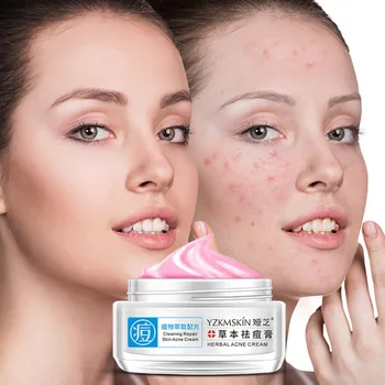 Herbal Acne Treatment Cream Moisturizing Oil-control Anti-inflammatory Anti-acne Cream
Herbal Acne Treatment Cream Moisturizing Oil-control Anti-inflammatory Anti-acne Cream