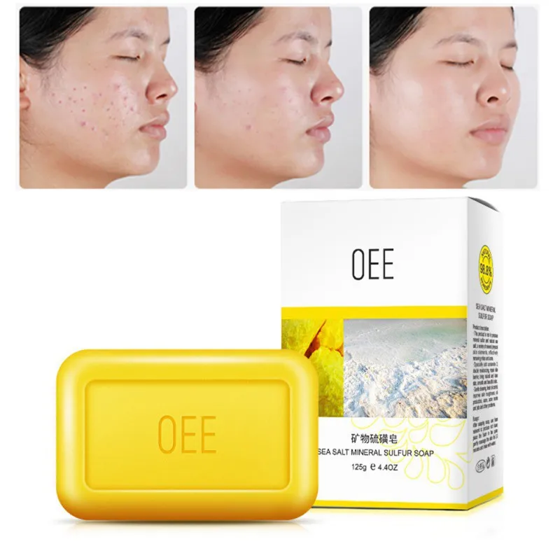 Sulfur Soap Control Oil Anti-mites Anti-acne Cleaning Pores Brighten Skin Color Face Body Soap
Sulfur Soap Control Oil Anti-mites Anti-acne Cleaning Pores Brighten Skin Color Face Body Soap