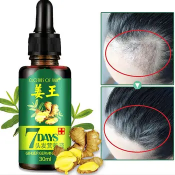 30ml Ginger Hair Growth Serum Essence for Women and Men Anti Hair Loss Liquid Damaged Hair Repair Growing Faster Repair
30ml Ginger Hair Growth Serum Essence for Women and Men Anti Hair Loss Liquid Damaged Hair Repair Growing Faster Repair