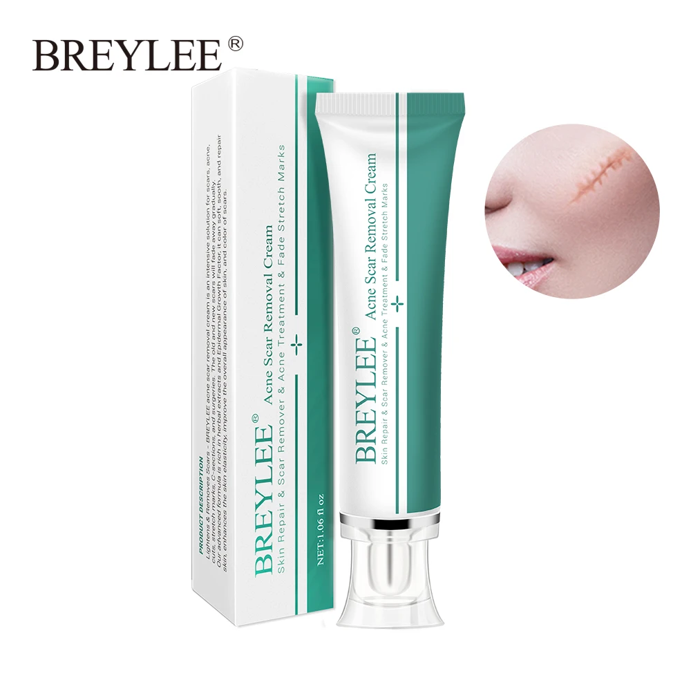 BREYLEE Acne Scar Removal Cream Face Cream Skin Repair Skin Care Scar Acne Treatment Remove Stretch Marks Whitening Cream 30g
BREYLEE Acne Scar Removal Cream Face Cream Skin Repair Skin Care Scar Acne Treatment Remove Stretch Marks Whitening Cream 30g
