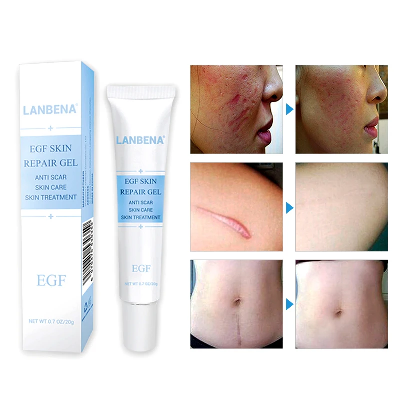 LANBENA Scar Repair Cream Scar Remover Skin Care Gel Pigmentation Corrector Acne Scar Removal Cream Acne Treatment
LANBENA Scar Repair Cream Scar Remover Skin Care Gel Pigmentation Corrector Acne Scar Removal Cream Acne Treatment