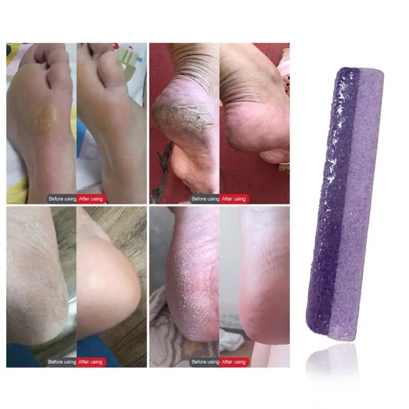1pc Pumice Stone Feet Hard Skin Callus Remover Foot Smooth Bath Clean Scrubber Smooth Foot Care Pedicure Tool
1pc Pumice Stone Feet Hard Skin Callus Remover Foot Smooth Bath Clean Scrubber Smooth Foot Care Pedicure Tool