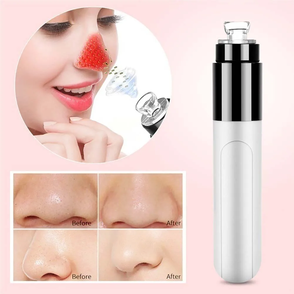 1 PC Mini Electric Facial Blackhead Remover Face Pore Cleansing Tool Kit Skin Cleaner Face Dirt Suck Up Vacuum Tool
1 PC Mini Electric Facial Blackhead Remover Face Pore Cleansing Tool Kit Skin Cleaner Face Dirt Suck Up Vacuum Tool