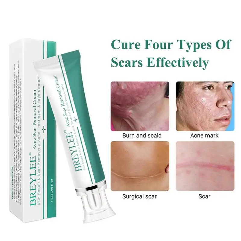 30g Removal Scar Cream Face Pimples Scar Repair Stretch Marks Remove Acne Treatment Whitening Moisturizing Cream Skin Care
30g Removal Scar Cream Face Pimples Scar Repair Stretch Marks Remove Acne Treatment Whitening Moisturizing Cream Skin Care