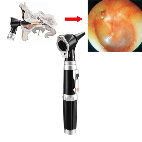 

Professional LED Bright Illumination Otoscope Auriscope Diagnostic Ear Care Mirror Kit