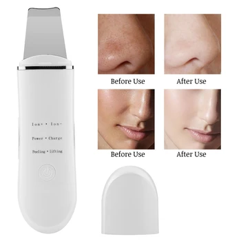 Ultrasonic Vibration Facial Skin Scrubber Ions Deep Cleansing Spatula Blackhead Grease Removal
Ultrasonic Vibration Facial Skin Scrubber Ions Deep Cleansing Spatula Blackhead Grease Removal