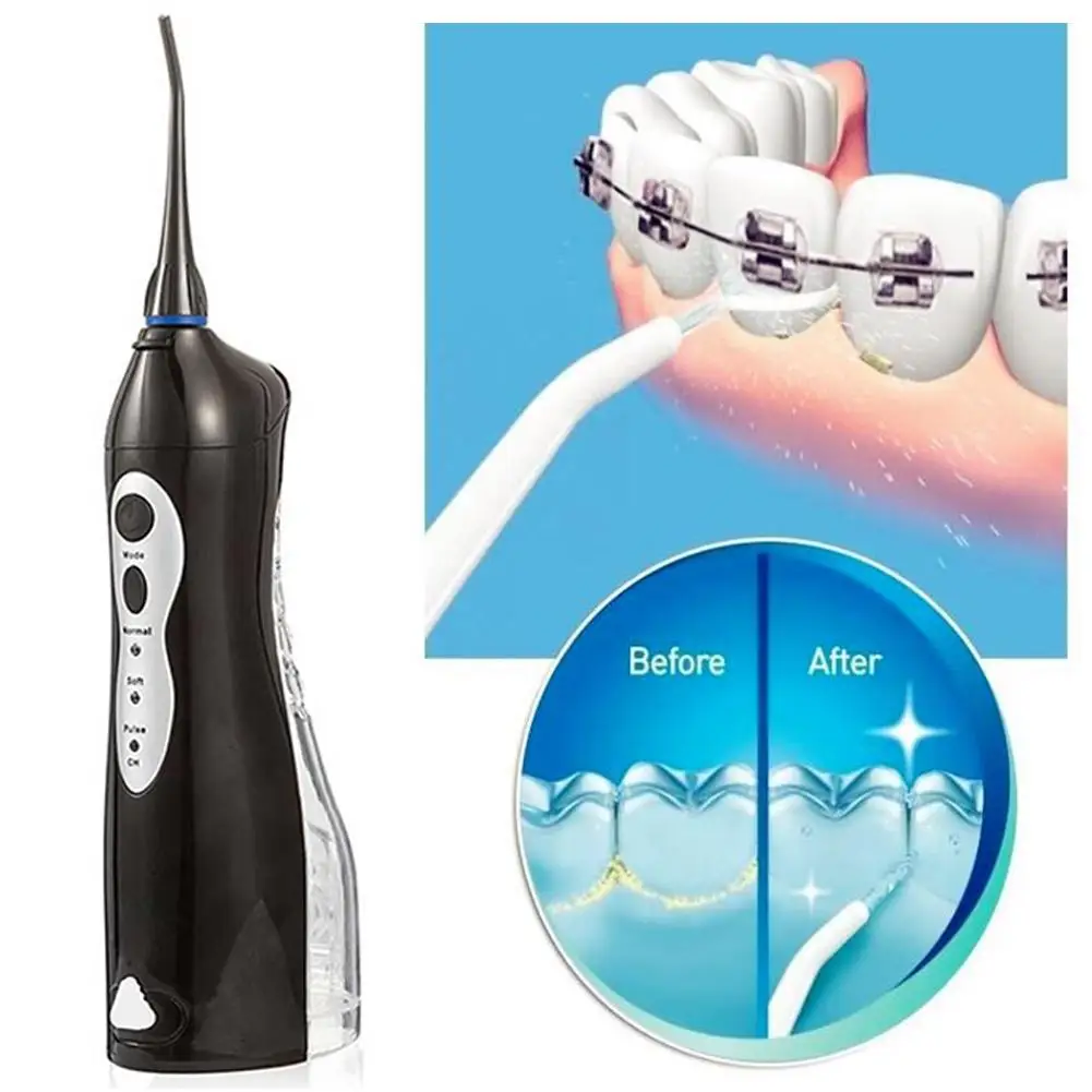Professional Electric Dental Scaler Tooth Calculus Remover Tooth Stains Tartar Tool Dentist Whiten Teeth Health Hygiene white
Professional Electric Dental Scaler Tooth Calculus Remover Tooth Stains Tartar Tool Dentist Whiten Teeth Health Hygiene white