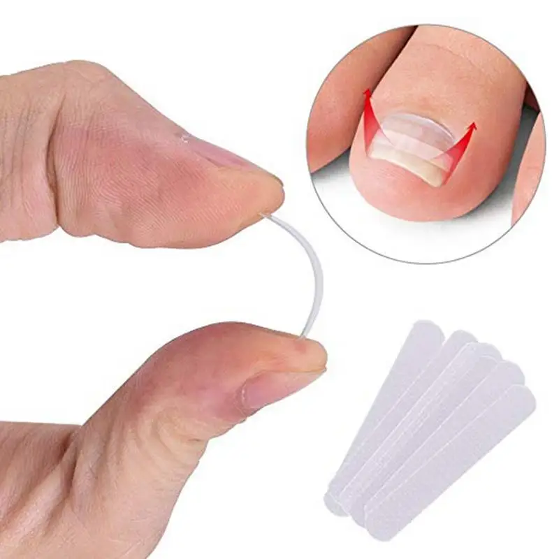 10PCS Ingrown Toe Nail Correction Sticker Patch Paronychia Corrector File Elastic Patch Corrector Foot Care Treatment Pedicure
10PCS Ingrown Toe Nail Correction Sticker Patch Paronychia Corrector File Elastic Patch Corrector Foot Care Treatment Pedicure
