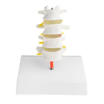 1: 1 Lumbar Vertebra Skeleton Model 4 Parts Medical Anatomical Model for School Teaching Tool Learning Display Lab Supplies
1: 1 Lumbar Vertebra Skeleton Model 4 Parts Medical Anatomical Model for School Teaching Tool Learning Display Lab Supplies
