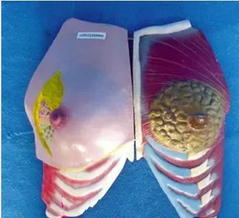 Female Breast Model Health and Sick Breast Anatomy Model Female Genital Anatomical Model Pathological Breast Medical Teaching
Female Breast Model Health and Sick Breast Anatomy Model Female Genital Anatomical Model Pathological Breast Medical Teaching