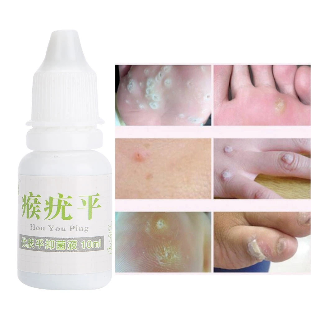 10ml Natural Ingredients Skin Care Wart Remover Eye Tag Remover Liquid Massage Relaxation b
10ml Natural Ingredients Skin Care Wart Remover Eye Tag Remover Liquid Massage Relaxation b