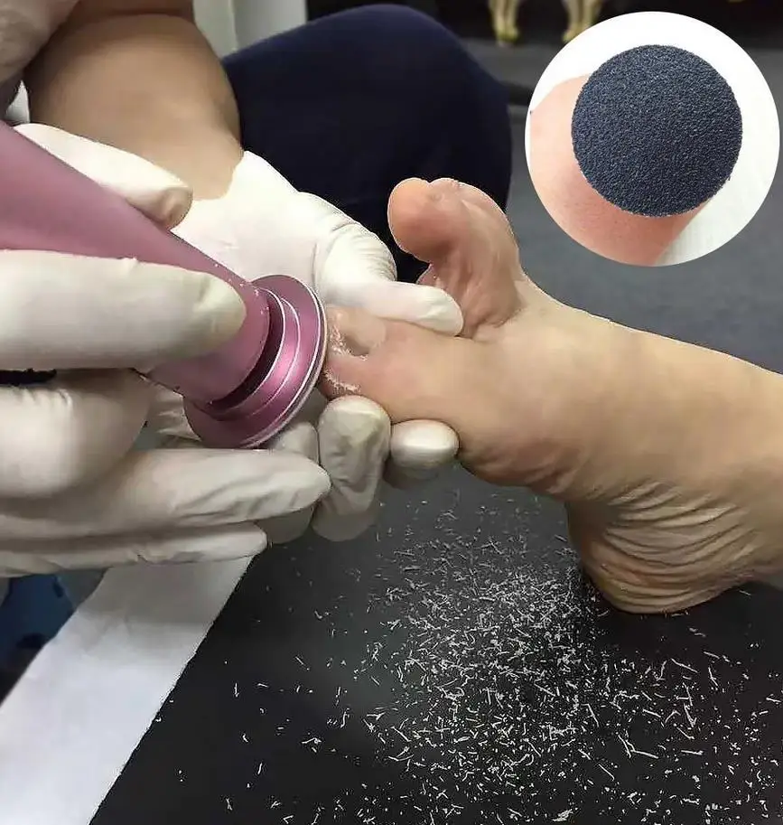 Electric Pedicure Foot Care Tool Files Pedicure Callus Remover Rechargeable Sawing File For Feet Dead Skin Callus Peel Remover
Electric Pedicure Foot Care Tool Files Pedicure Callus Remover Rechargeable Sawing File For Feet Dead Skin Callus Peel Remover