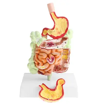 Human Pathological skeleton Anatomical Intestine Stomach Model surgical anatomical traumatic pistols condoms instruments
Human Pathological skeleton Anatomical Intestine Stomach Model surgical anatomical traumatic pistols condoms instruments