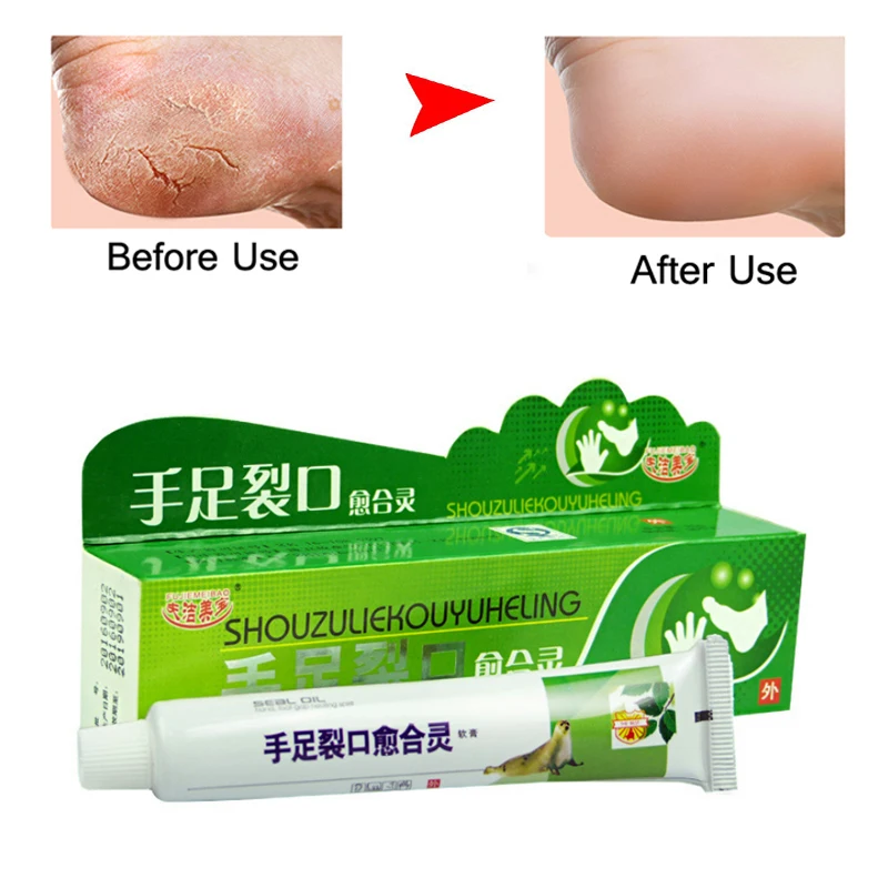 Powerful Chinese Ointment Cream Hand Foot Crack Cream Heel Chapped Peeling Foot and hand Repair Anti Dry Crack skin care
Powerful Chinese Ointment Cream Hand Foot Crack Cream Heel Chapped Peeling Foot and hand Repair Anti Dry Crack skin care