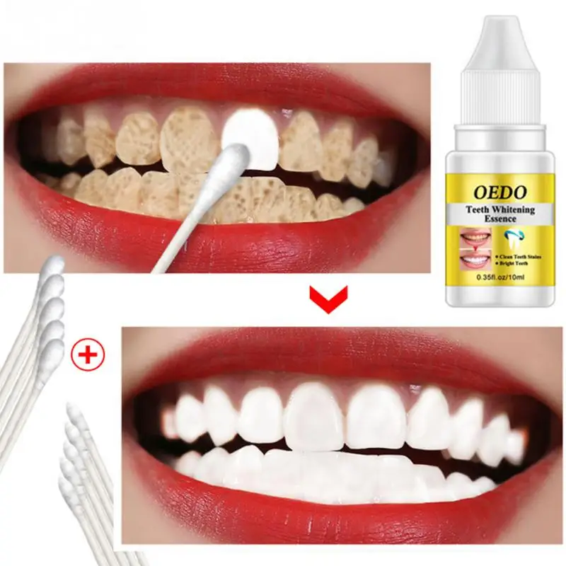 10ml Whitening Serum Bleaching Clean Stain Tooth Cleaner Cleaning Liquid Essence Dental
10ml Whitening Serum Bleaching Clean Stain Tooth Cleaner Cleaning Liquid Essence Dental