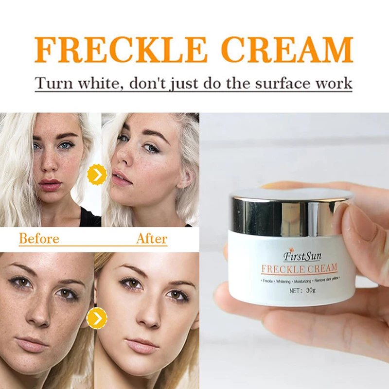 30g Freckle Whitening Cream Face Care Fade Speckle Melasma Pigment Melanin Sunburn Acne brown Spots Corrector Skin Serum
30g Freckle Whitening Cream Face Care Fade Speckle Melasma Pigment Melanin Sunburn Acne brown Spots Corrector Skin Serum