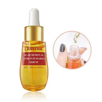 Acne Essence Care Remove Stretch Mark Anti-Acne Shrinkage Pore Blackhead Repair Essence for Facial Skin care 
Acne Essence Care Remove Stretch Mark Anti-Acne Shrinkage Pore Blackhead Repair Essence for Facial Skin care