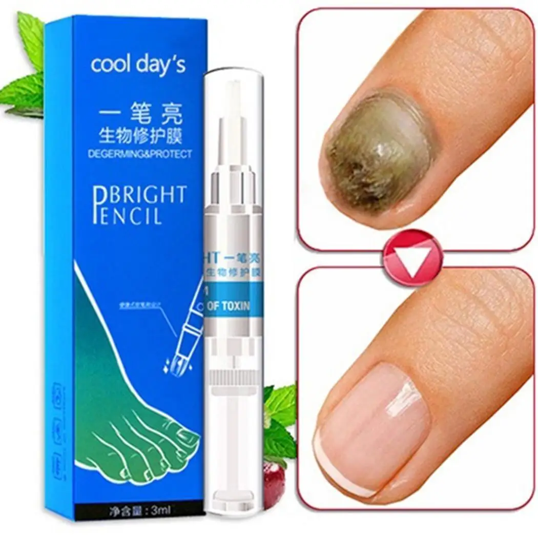 Nail Treatment Pen for Remove Nail Fungus Natural Nail The bottle is small and easy to carry. Biological Repair
Nail Treatment Pen for Remove Nail Fungus Natural Nail The bottle is small and easy to carry. Biological Repair