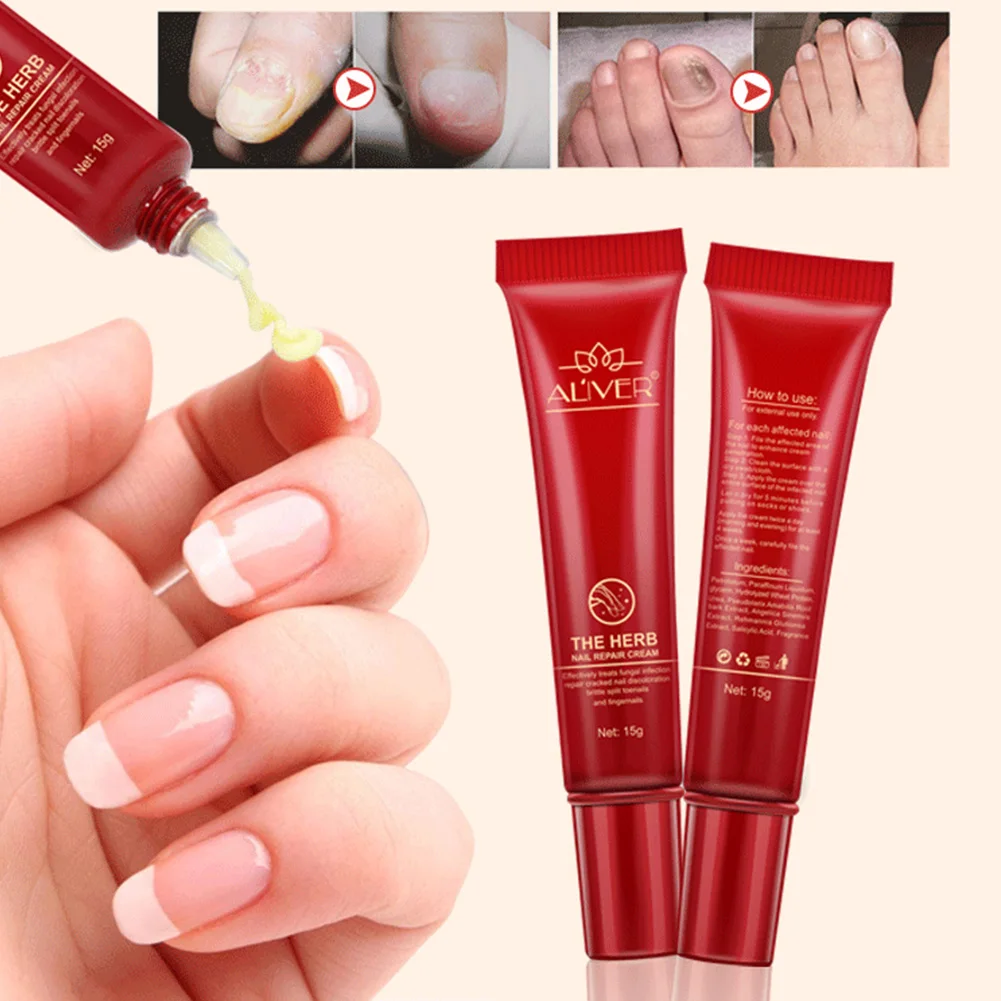 Universal Nail Protector Treatment Nail Repair Cream Smooth Fungus Stop Skin Care Moisturizing Herb For Finger And Toe Natural
Universal Nail Protector Treatment Nail Repair Cream Smooth Fungus Stop Skin Care Moisturizing Herb For Finger And Toe Natural
