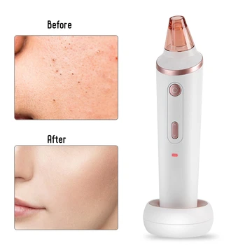 Electric Blackhead Vacuum Suction Removal Pore Cleaner Wireless Skin Cleaning Tools Device
Electric Blackhead Vacuum Suction Removal Pore Cleaner Wireless Skin Cleaning Tools Device
