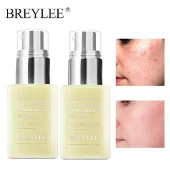 BREYLEE Face Cream Shea Butter Moisturizing Lotion Skin Care Anti Acne Treatment Facial Emulsion Easy To Absorb Day Night Cream
BREYLEE Face Cream Shea Butter Moisturizing Lotion Skin Care Anti Acne Treatment Facial Emulsion Easy To Absorb Day Night Cream