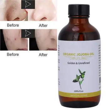 18ml Natural Organic Jojoba Oil Moisturizing Pure Unrefined Hair Skin Care Essence Oil Blackhead Removal Massage Essence Oil 
18ml Natural Organic Jojoba Oil Moisturizing Pure Unrefined Hair Skin Care Essence Oil Blackhead Removal Massage Essence Oil