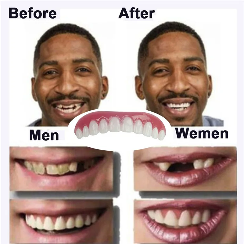 Rakado 1PC Upper Bottom Row White Teeth Silicone Simulation Dentures Set Veneers Flex Denture Perfect Paste Tooth Whitening Tool
Rakado 1PC Upper Bottom Row White Teeth Silicone Simulation Dentures Set Veneers Flex Denture Perfect Paste Tooth Whitening Tool