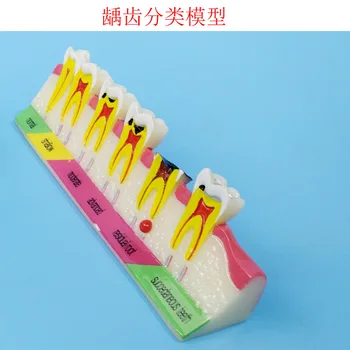 Human Tooth Anatomical Model Dental Caries Anatomical Model Caries Anatomy Human Oral Teaching Models Tooth Pathology Model
Human Tooth Anatomical Model Dental Caries Anatomical Model Caries Anatomy Human Oral Teaching Models Tooth Pathology Model