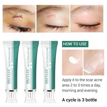 30g Removal Scar Cream Skin Repair Face Cream Acne Spots Stretch Marks Remove Acne Skin Care Whitening Moisturizing Cream
30g Removal Scar Cream Skin Repair Face Cream Acne Spots Stretch Marks Remove Acne Skin Care Whitening Moisturizing Cream