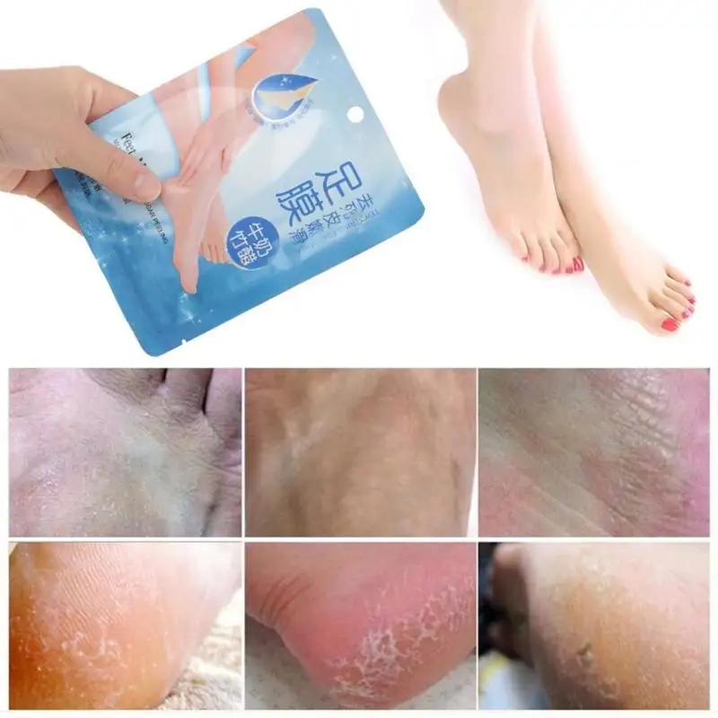 2pcs Bamboo Vinegar Milk Foot Mask Exfoliating Renewal Pedicure Feet Mask Foot Care Peeling Health Care
2pcs Bamboo Vinegar Milk Foot Mask Exfoliating Renewal Pedicure Feet Mask Foot Care Peeling Health Care