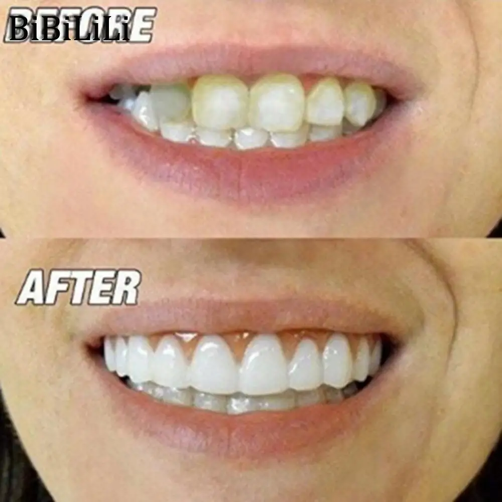 Natural Comfortable Silicone Perfect Smile Veneers Men Women Teeth Upper Cosmetic Veneer Tooth Cover Beauty Tool Teeth Whitening
Natural Comfortable Silicone Perfect Smile Veneers Men Women Teeth Upper Cosmetic Veneer Tooth Cover Beauty Tool Teeth Whitening