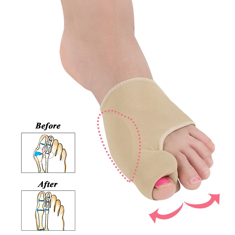 Foot Deformity Hallux Valgus Bunion Corrector Orthotics Toe Separator Bone Thumb Adjuster Brace Pedicure Socks Straightener
Foot Deformity Hallux Valgus Bunion Corrector Orthotics Toe Separator Bone Thumb Adjuster Brace Pedicure Socks Straightener