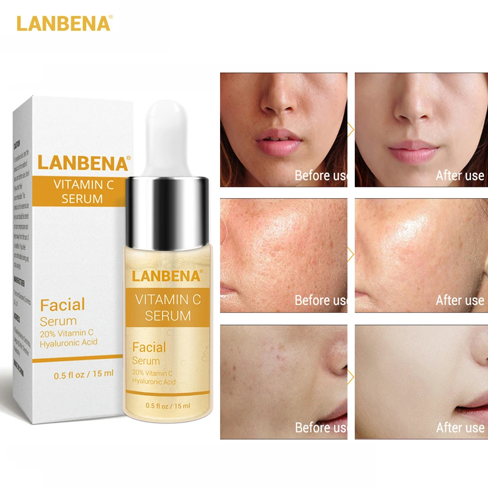 LANBENA Vitamin C Whitening Serum Hyaluronic Acid Face Cream Snail Remover Freckle Speckle Fade Dark Spots Anti-Aging Skin Care
LANBENA Vitamin C Whitening Serum Hyaluronic Acid Face Cream Snail Remover Freckle Speckle Fade Dark Spots Anti-Aging Skin Care