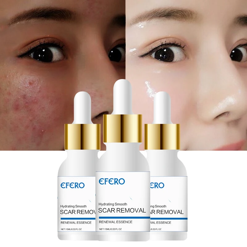 Shrink Pores Essential Oils Hyaluronic Acid Moisturizing Face Serum Whitening Plant Skin Care Anti Aging Wrinkle Cream Face Oil
Shrink Pores Essential Oils Hyaluronic Acid Moisturizing Face Serum Whitening Plant Skin Care Anti Aging Wrinkle Cream Face Oil