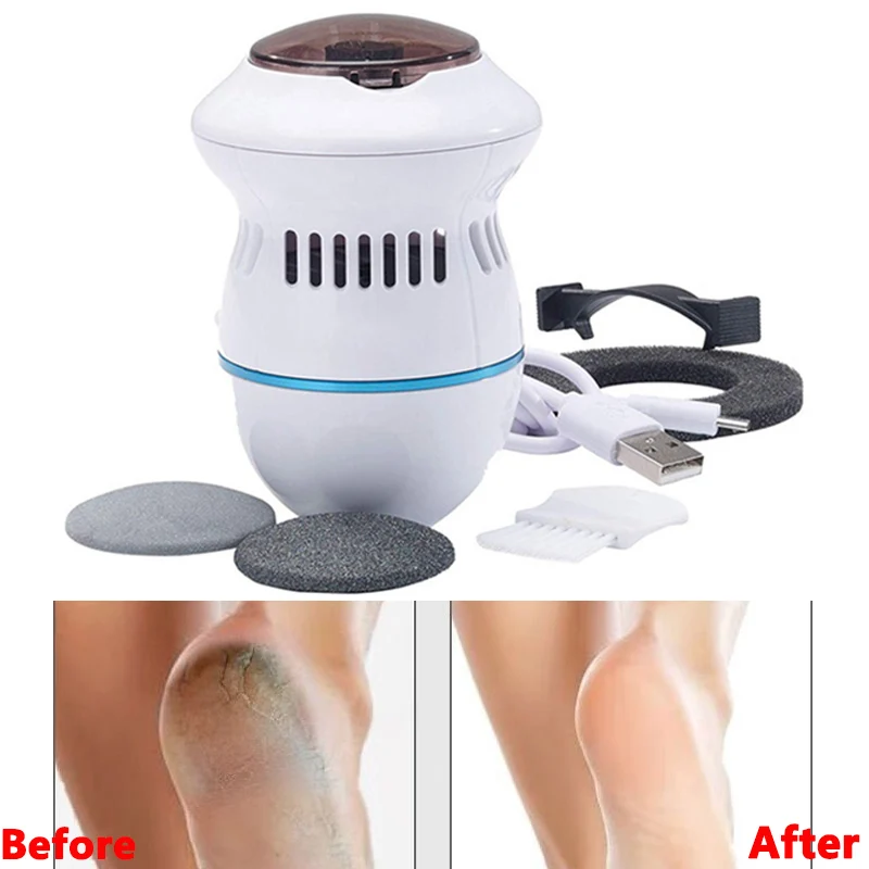 New Arrivals Pedi Remover Vac Rechargeable Electronic Foot Files Clean Tools Feet Care Perfect for Hard Cracked Skin Dropshiping
New Arrivals Pedi Remover Vac Rechargeable Electronic Foot Files Clean Tools Feet Care Perfect for Hard Cracked Skin Dropshiping