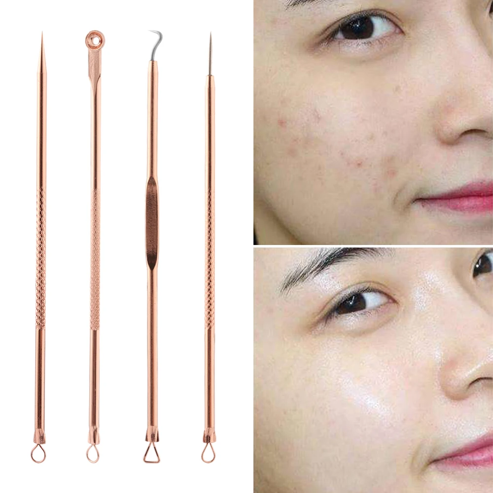 Premium Blackhead Acne Comedone Pimple Blemish Extractor Remover Tool Blackhead Pimple Needles Face Skin Care Makeup Tools
Premium Blackhead Acne Comedone Pimple Blemish Extractor Remover Tool Blackhead Pimple Needles Face Skin Care Makeup Tools