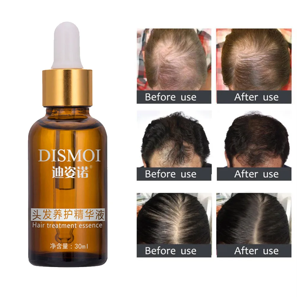 Hair Growth Essence liquid Fast Natural Hair Loss Treatment Essential Oil Liquid Treatment anti Hair Loss Care 2019
Hair Growth Essence liquid Fast Natural Hair Loss Treatment Essential Oil Liquid Treatment anti Hair Loss Care 2019