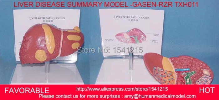 HUMAN LIVER MODEL ANATOMICAL MODEL MEDICAL SCIENCE TEACHING SUPPLIES,HUMAN LIVER MODEL,LIVER MEDICAL MODEL-GASEN-RZRTXH011
HUMAN LIVER MODEL ANATOMICAL MODEL MEDICAL SCIENCE TEACHING SUPPLIES,HUMAN LIVER MODEL,LIVER MEDICAL MODEL-GASEN-RZRTXH011