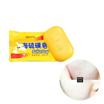 Hot sale Handmade Sulfur Soap 85g acne whitening soap deep cleansing oil-control Anti-wrinkle moisturizing
Hot sale Handmade Sulfur Soap 85g acne whitening soap deep cleansing oil-control Anti-wrinkle moisturizing
