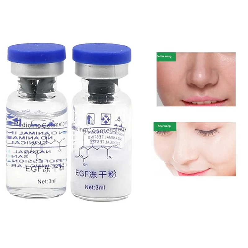One Set /2Pcs EGF Lyophilized Epidermal Growth Factor EGF Powder Serum Acne Pimples Scars Wrinkles Treatment Skin Care DGF5705
One Set /2Pcs EGF Lyophilized Epidermal Growth Factor EGF Powder Serum Acne Pimples Scars Wrinkles Treatment Skin Care DGF5705