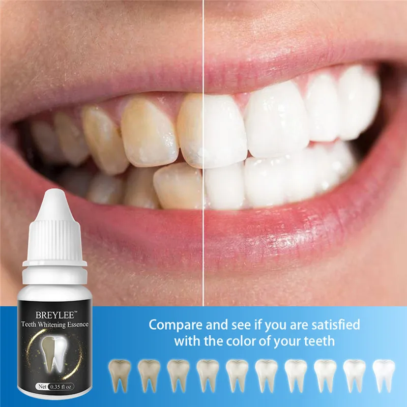 10ml Teeth Whitening Essence Cleaning Serum Oral Hygiene White Gel Teeth Care Tooth Bleaching Dental Tools
10ml Teeth Whitening Essence Cleaning Serum Oral Hygiene White Gel Teeth Care Tooth Bleaching Dental Tools
