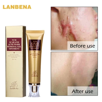 LANBENA Acne Scar Removal Cream Skin Repair Face Cream Acne Spots Acne Treatment Blackhead Whitening Cream Stretch Marks 30ml
LANBENA Acne Scar Removal Cream Skin Repair Face Cream Acne Spots Acne Treatment Blackhead Whitening Cream Stretch Marks 30ml